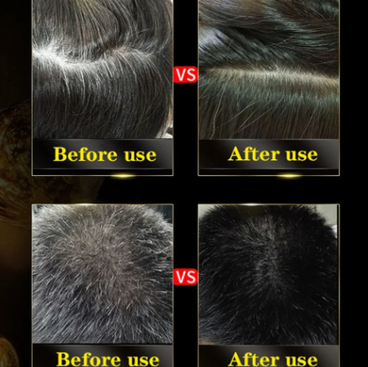 3-in-1 Black Hair Dye Shampoo – Hair Colour Shampoo for Men & Women (100ml) - New Packaging